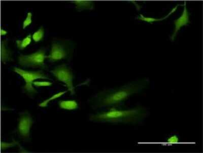 Immunocytochemistry/ Immunofluorescence: UGT2B4 Antibody (2H6) [H00007363-M01]