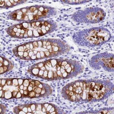 Immunohistochemistry-Paraffin: UGT2B4 Antibody [NBP2-54718]