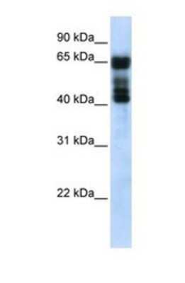 Western Blot: UGT2B4 Antibody [NBP1-69604]