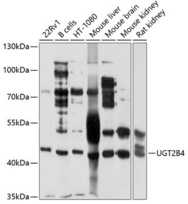 Western Blot: UGT2B4 AntibodyBSA Free [NBP2-94881]