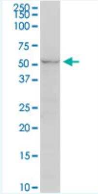Western Blot: UGT2B7 Antibody (8D12) [H00007364-M02-100ug]