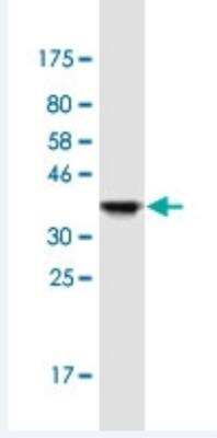 Western Blot: UGT2B7 Antibody (8D12) [H00007364-M02-100ug]