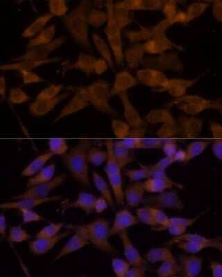 Immunocytochemistry/ Immunofluorescence: UGT2B7 Antibody - Azide and BSA Free [NBP2-94823]