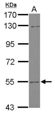 Western Blot: UGT2B7 Antibody [NBP2-15155]