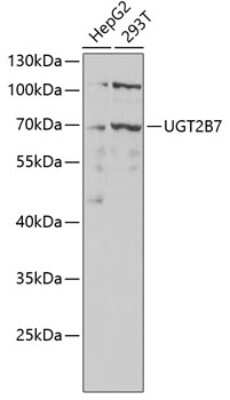 Western Blot: UGT2B7 AntibodyAzide and BSA Free [NBP2-94823]