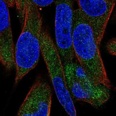 Immunocytochemistry/ Immunofluorescence: UGT3A1 Antibody [NBP2-55748]