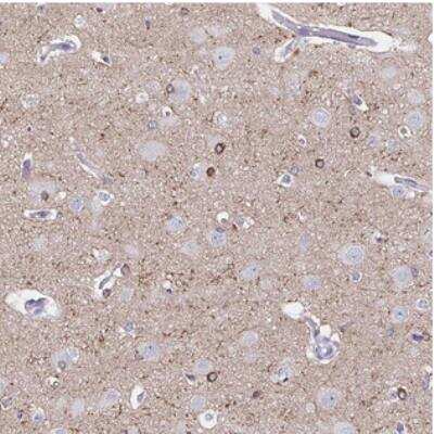 Immunohistochemistry: UGT3A1 Antibody [NBP2-31025]