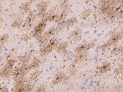 Immunohistochemistry-Paraffin: UGT3A1 Antibody [NBP3-06222]