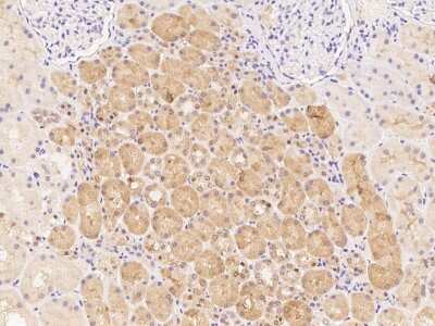 Immunohistochemistry-Paraffin: UGT3A1 Antibody [NBP3-06222]
