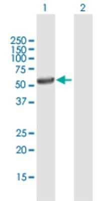 Western Blot: UGT3A1 Antibody [H00133688-B01P]