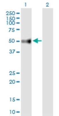 Western Blot: UGT3A2 Antibody [H00167127-B01P]