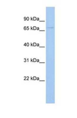 Western Blot: UGT3A2 Antibody [NBP1-69422]