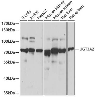 Western Blot: UGT3A2 AntibodyBSA Free [NBP2-93386]