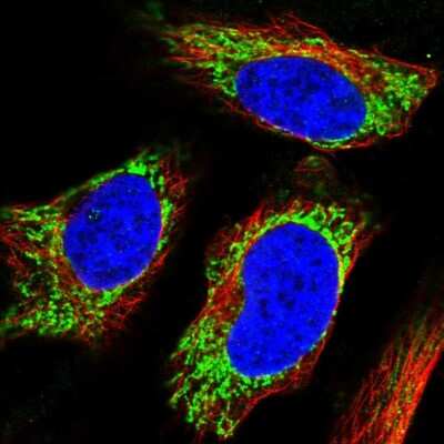 Immunocytochemistry/ Immunofluorescence: UGT8 Antibody [NBP2-56391]