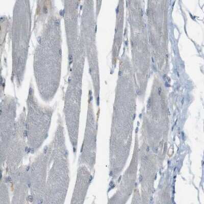 Immunohistochemistry-Paraffin: UGT8 Antibody [NBP1-84494]
