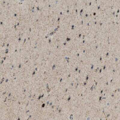 Immunohistochemistry-Paraffin: UGT8 Antibody [NBP1-84494]