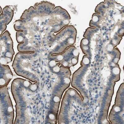 Immunohistochemistry-Paraffin: UGT8 Antibody [NBP1-84494]