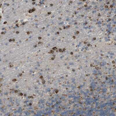 Immunohistochemistry-Paraffin: UGT8 Antibody [NBP1-84494]