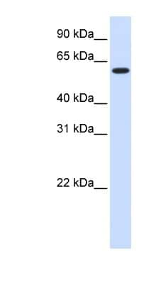 Western Blot: UGT8 Antibody [NBP1-62245]