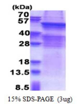 SDS-PAGE: Recombinant Human UGT8 His Protein [NBP2-22928]