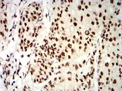 Immunohistochemistry: UHRF1 Antibody (1A1B1) - BSA Free [NBP2-61838]