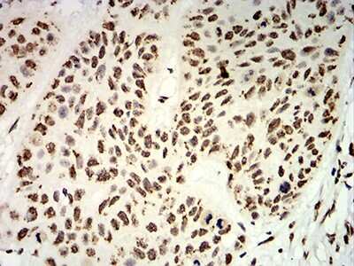 Immunohistochemistry: UHRF1 Antibody (1A1B1) - BSA Free [NBP2-61838]