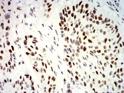 Immunohistochemistry: UHRF1 Antibody (2A8C7) - BSA Free [NBP2-61830]