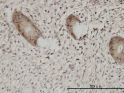 Immunohistochemistry-Paraffin: UHRF1 Antibody (3A11) [H00029128-M01]