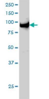 Western Blot: UHRF1 Antibody (3A11) [H00029128-M01]