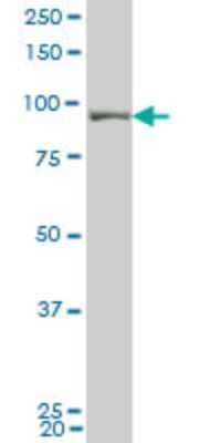 Western Blot: UHRF1 Antibody (3B12) [H00029128-M02]