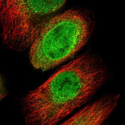 Immunocytochemistry/ Immunofluorescence: ICBP90 Binding Protein 1 Antibody [NBP1-88255]