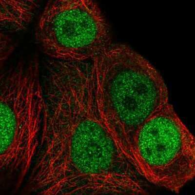 Immunocytochemistry/ Immunofluorescence: UHRF1 Antibody [NBP2-13504]