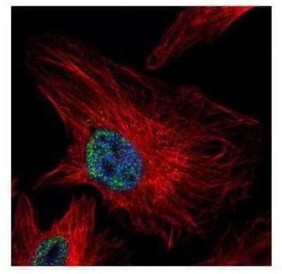 Immunocytochemistry/ Immunofluorescence: UHRF1 Antibody [NBP2-20806]