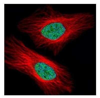 Immunocytochemistry/ Immunofluorescence: UHRF1 Antibody [NBP2-20807]