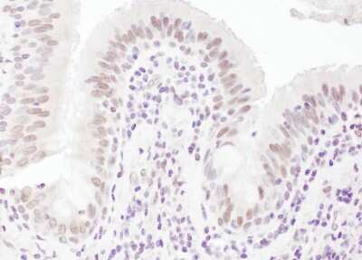 Immunohistochemistry: UHRF1 Antibody [NB100-74597]