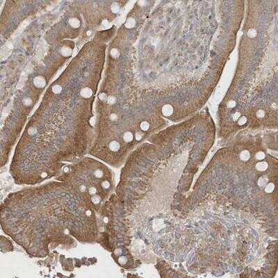 Immunohistochemistry: ICBP90 Binding Protein 1 Antibody [NBP1-88255]