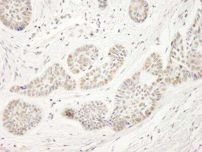 Immunohistochemistry-Paraffin: UHRF1 Antibody [NB100-74597]