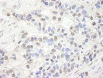 Immunohistochemistry-Paraffin: UHRF1 Antibody [NB100-74597]