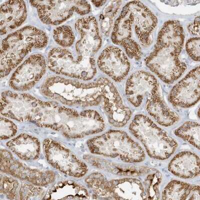 Immunohistochemistry-Paraffin: ICBP90 Binding Protein 1 Antibody [NBP1-88254]