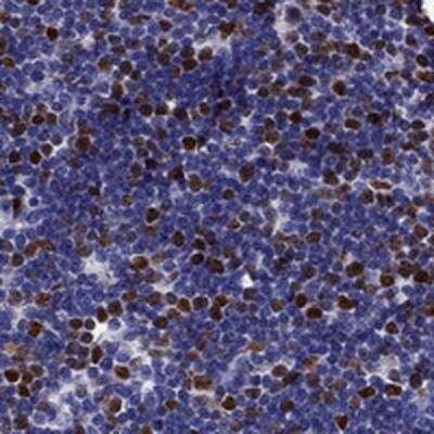 Immunohistochemistry-Paraffin: UHRF1 Antibody [NBP2-13504]