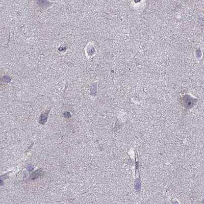 Immunohistochemistry-Paraffin: UHRF1 Antibody [NBP2-13504]