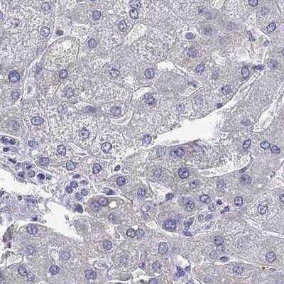 Immunohistochemistry-Paraffin: UHRF1 Antibody [NBP2-13504]