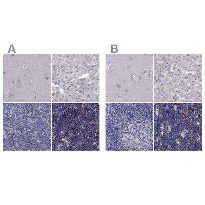 Immunohistochemistry-Paraffin: UHRF1 Antibody [NBP2-13504]
