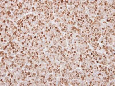 Immunohistochemistry-Paraffin: UHRF1 Antibody [NBP2-20806]