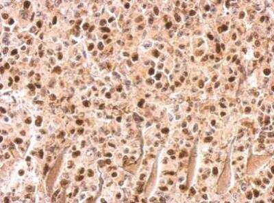 Immunohistochemistry-Paraffin: UHRF1 Antibody [NBP2-20807]