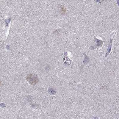 Immunohistochemistry-Paraffin: UHRF1 Antibody [NBP2-68720]