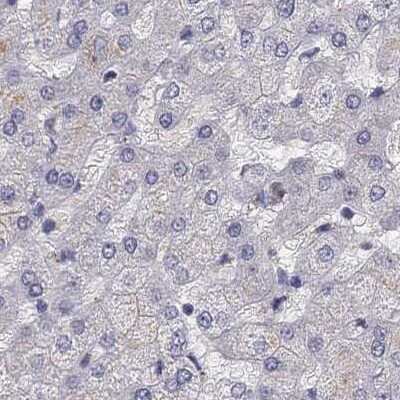 Immunohistochemistry-Paraffin: UHRF1 Antibody [NBP2-68720]