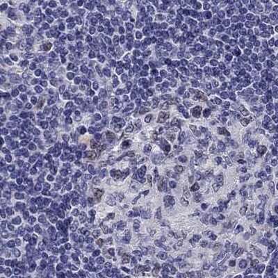 Immunohistochemistry-Paraffin: UHRF1 Antibody [NBP2-68720]