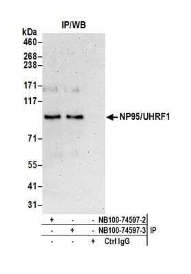Immunoprecipitation: UHRF1 Antibody [NB100-74597]