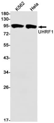 Western Blot: UHRF1 Antibody (S06-1C4) [NBP3-19511]